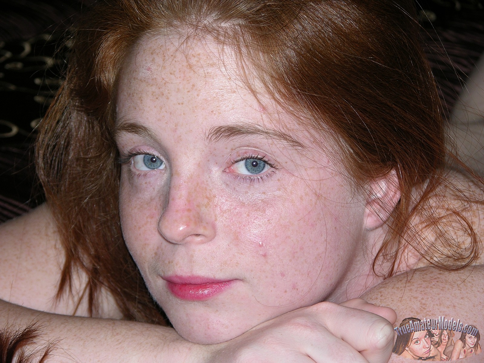 Results for : hairy redhead freckles