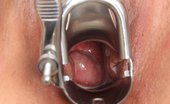 Old Pussy Exam 350665 