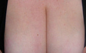 Divine Breasts 406526 Kelly Macromastia Huge Breasts
