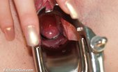 Exclusive Club Kate 421198 Kate Gyno Pussy Speculum Examination At Gyno Setup By Old Clinician
