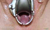 Exclusive Club Viktorie 421228 Viktorie Very Kinky Gyno Pussy Speculum Examination At Gynecology Practice By Untidy Doc
