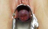 Exclusive Club Sam 421233 Sam Extreme Pussy Speculum Gaping At Gyn Practice By Dirty Female Doctor
