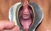 Exclusive Club Pic 421259 Terra Joy Vagina Exam At Untidy Gyno Clinic
