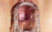 Exclusive Club Jessica 421286 Jessica Vulva Inspection With Gynecological Tool And Other Gyno Tools
