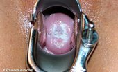 Exclusive Club Sara 421294 Sara Gyno Tool Cunt Gaping At Old Gynoclinic
