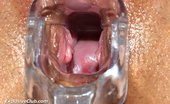 Exclusive Club Sara 421294 Sara Gyno Tool Cunt Gaping At Old Gynoclinic
