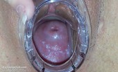Exclusive Club Scarlet 421424 Scarlet Very Kinky Gyno Puss Speculum Checkup
