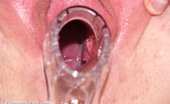 Exposed Nurses Jenny 421567 Perverse Nurse Jenny Masturbating With Big Rubber Cock And Vaginal Speculum At Gyno Clinic
