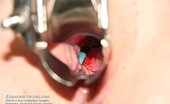 Exposed Nurses Rita 421634 Skilled Nurse Rita Fuck Hole Spread And Vagina Spreader Play
