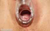 Naughty Head Nurse 470834 Ladislava Ladislava Elder Deviated Nurse Cunny Sex Toy Masturbation On Gynochair Naughty Head Nurse
