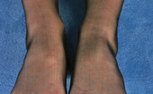 Nylon Feet Line 563542 Essie Pig-Tailed Babe Can Set Any Male On Fire While Teasing With Her Lacy Tights Nylon Feet Line
